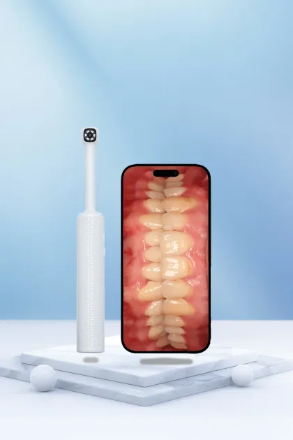 Intraoral Camera