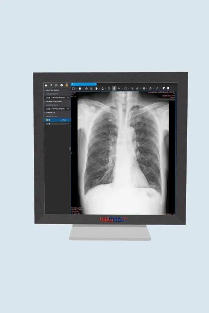Smart Dicom Viewer