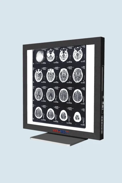 Smart Dicom Viewer