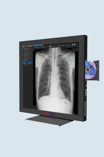 Smart Dicom Viewer